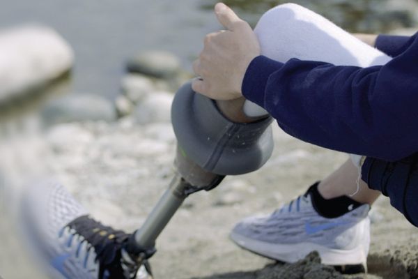 Below the knee amputee with hand on socket liner
