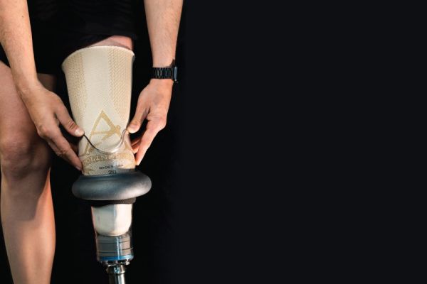 man donning lower leg prosthesis