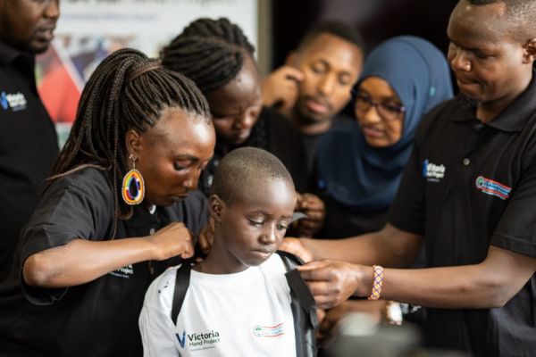 young boy being fitted with prosthetic arm